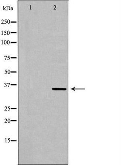 Invitrogen MNAT1 Polyclonal Antibody 100 &mu;L | Buy Online | Invitrogen&trade; | Fisher Scientific