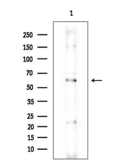 Invitrogen Uromodulin Polyclonal Antibody 100 &mu;L | Buy Online | Invitrogen&trade; | Fisher Scientific