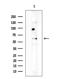 Invitrogen Uromodulin Polyclonal Antibody 100 &mu;L | Buy Online | Invitrogen&trade; | Fisher Scientific