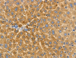 Invitrogen CD204 Polyclonal Antibody 100 &mu;L | Buy Online | Invitrogen&trade; | Fisher Scientific