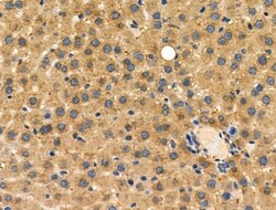 Invitrogen CD204 Polyclonal Antibody 100 &mu;L | Buy Online | Invitrogen&trade; | Fisher Scientific