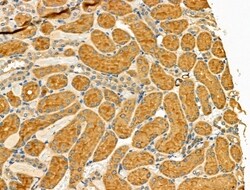 Invitrogen CD204 Polyclonal Antibody 100 &mu;L | Buy Online | Invitrogen&trade; | Fisher Scientific