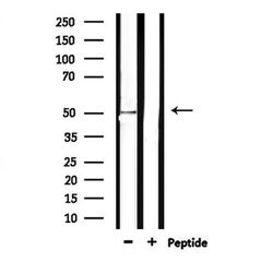 Invitrogen CD204 Polyclonal Antibody 100 &mu;L | Buy Online | Invitrogen&trade; | Fisher Scientific