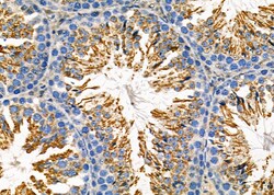Invitrogen GPX4 Polyclonal Antibody 100 &mu;L; Unconjugated:Antibodies,