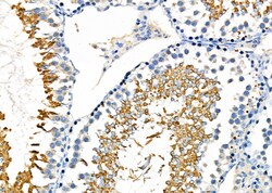 Invitrogen GPX4 Polyclonal Antibody 100 &mu;L; Unconjugated:Antibodies,