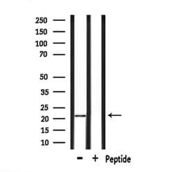 Invitrogen GPX4 Polyclonal Antibody 100 &mu;L; Unconjugated:Antibodies,