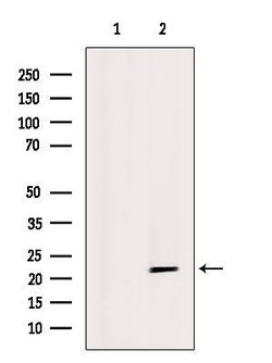 Invitrogen GPX4 Polyclonal Antibody 100 &mu;L; Unconjugated:Antibodies,