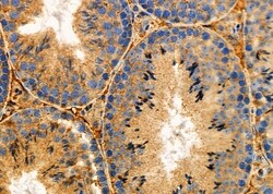 Invitrogen RCAS1 Polyclonal Antibody 100 &mu;L; Unconjugated:Antibodies,