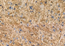 Invitrogen GluR6 Polyclonal Antibody 100 &mu;L; Unconjugated:Antibodies,