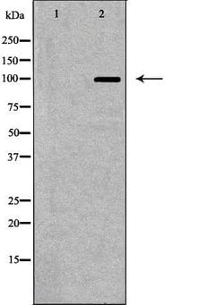 Invitrogen GluR6 Polyclonal Antibody 100 &mu;L; Unconjugated:Antibodies,