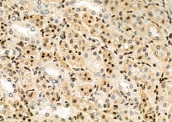 Invitrogen POLI Polyclonal Antibody 100 &mu;L | Buy Online | Invitrogen&trade; | Fisher Scientific