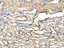 Invitrogen Glypican 3 Polyclonal Antibody 100 &mu;L | Buy Online | Invitrogen&trade; | Fisher Scientific