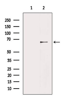 Invitrogen Glypican 3 Polyclonal Antibody 100 &mu;L | Buy Online | Invitrogen&trade; | Fisher Scientific