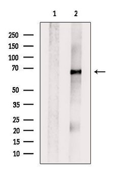 Invitrogen Glypican 3 Polyclonal Antibody 100 &mu;L | Buy Online | Invitrogen&trade; | Fisher Scientific