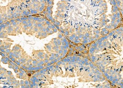 Invitrogen ODC1 Polyclonal Antibody 100 &mu;L; Unconjugated:Antibodies,