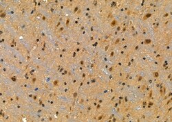 Invitrogen PSMD10 Polyclonal Antibody 100 &mu;L; Unconjugated:Antibodies,