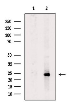 Invitrogen PSMD10 Polyclonal Antibody 100 &mu;L; Unconjugated:Antibodies,