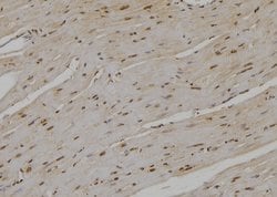 UBE2D1 Polyclonal Antibody 100 &mu;L | Buy Online | Thermo Scientific | Fisher Scientific