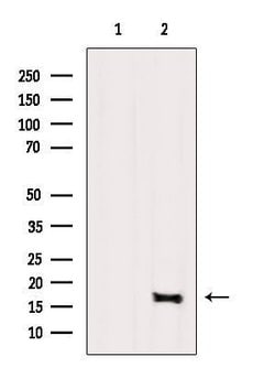 UBE2D1 Polyclonal Antibody 100 &mu;L | Buy Online | Thermo Scientific | Fisher Scientific