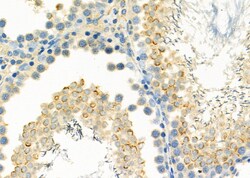 Invitrogen MB67 Polyclonal Antibody 100 &mu;L; Unconjugated:Antibodies,