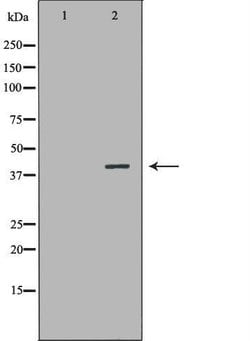 Invitrogen MB67 Polyclonal Antibody 100 &mu;L; Unconjugated:Antibodies,