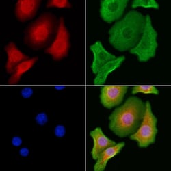 Invitrogen HSD17B2 Polyclonal Antibody 100 &mu;L; Unconjugated:Antibodies,