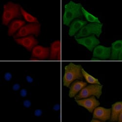 Invitrogen HSD17B2 Polyclonal Antibody 100 &mu;L; Unconjugated:Antibodies,