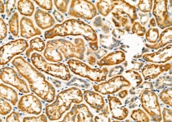 Invitrogen HSD17B2 Polyclonal Antibody 100 &mu;L; Unconjugated:Antibodies,