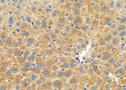 Invitrogen HSD17B2 Polyclonal Antibody 100 &mu;L; Unconjugated:Antibodies,