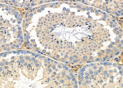Invitrogen HSD17B2 Polyclonal Antibody 100 &mu;L; Unconjugated:Antibodies,