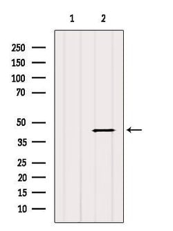 Invitrogen HSD17B2 Polyclonal Antibody 100 &mu;L; Unconjugated:Antibodies,