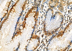 Invitrogen IPO5 Polyclonal Antibody 100 &mu;L | Buy Online | Invitrogen&trade; | Fisher Scientific