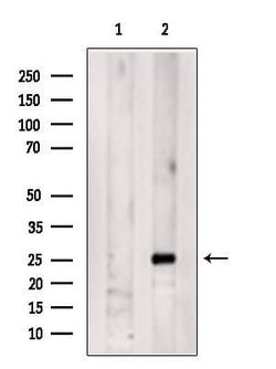 Serum Amyloid P Polyclonal Antibody 100 &mu;L | Buy Online | Invitrogen | Fisher Scientific