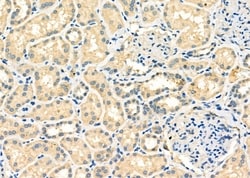 Invitrogen Cbl-b Polyclonal Antibody 100 &mu;L | Buy Online | Invitrogen&trade; | Fisher Scientific