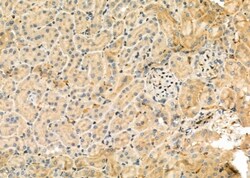Invitrogen Cbl-b Polyclonal Antibody 100 &mu;L | Buy Online | Invitrogen&trade; | Fisher Scientific
