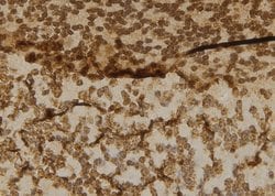 Invitrogen Cbl-b Polyclonal Antibody 100 &mu;L | Buy Online | Invitrogen&trade; | Fisher Scientific
