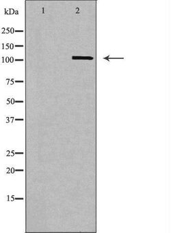 Invitrogen Cbl-b Polyclonal Antibody 100 &mu;L | Buy Online | Invitrogen&trade; | Fisher Scientific