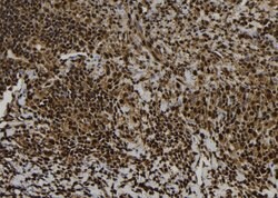 Invitrogen eIF5A Polyclonal Antibody 100 &mu;L; Unconjugated:Antibodies,