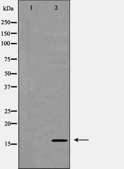 Invitrogen eIF5A Polyclonal Antibody 100 &mu;L; Unconjugated:Antibodies,