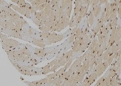 Invitrogen MT2A Polyclonal Antibody 100 &mu;L; Unconjugated:Antibodies,