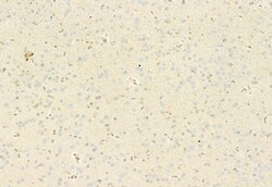 Invitrogen MT2A Polyclonal Antibody 100 &mu;L; Unconjugated:Antibodies,