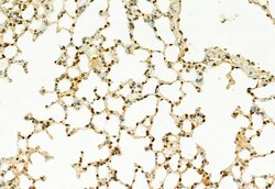 Invitrogen MT2A Polyclonal Antibody 100 &mu;L; Unconjugated:Antibodies,