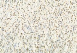 Invitrogen MT2A Polyclonal Antibody 100 &mu;L; Unconjugated:Antibodies,