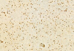 Invitrogen MT2A Polyclonal Antibody 100 &mu;L; Unconjugated:Antibodies,