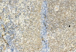Invitrogen MT2A Polyclonal Antibody 100 &mu;L; Unconjugated:Antibodies,