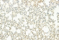 Invitrogen MT2A Polyclonal Antibody 100 &mu;L; Unconjugated:Antibodies,