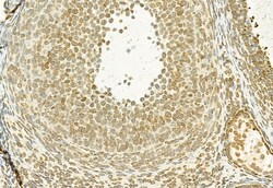 Invitrogen MT2A Polyclonal Antibody 100 &mu;L; Unconjugated:Antibodies,