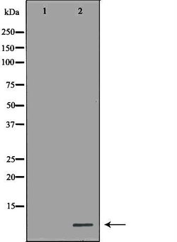Invitrogen MT2A Polyclonal Antibody 100 &mu;L; Unconjugated:Antibodies,