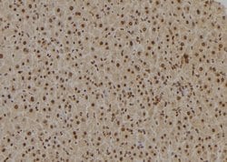 Invitrogen TAF9 Polyclonal Antibody 100 &mu;L | Buy Online | Invitrogen&trade; | Fisher Scientific