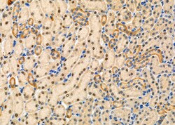 Invitrogen TAF9 Polyclonal Antibody 100 &mu;L | Buy Online | Invitrogen&trade; | Fisher Scientific